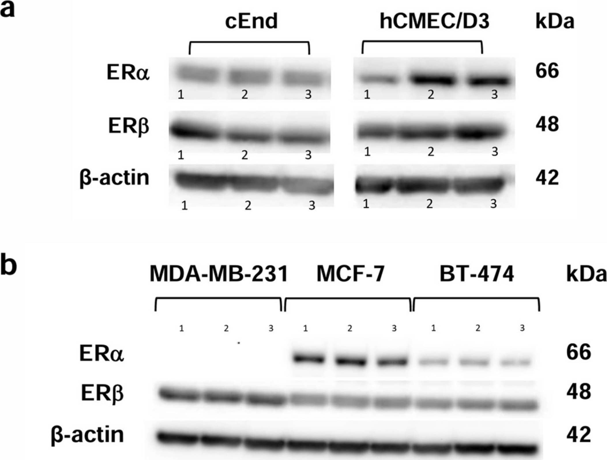 Western blot analysis showing the protein expression patterns of the estrogen receptors (ERs) ER alpha  (66 kDa) and ER beta  (48 kDa). (a) The murine brain endothelial cell lines cEND (left) and the human brain endothelial cell line hCMEC/D3 (right) show the presence of both ERs in three experimental runs (1, 2, 3). (b) The breast cancer (BC) cell lines showed the presence of ER beta  in MCF-7, BT-474 and MDA-MB-231 cells, whereas ER alpha  was only detected in MCF-7 and BT-474. Again, three experimental runs were performed (1, 2, 3).  beta -actin (42 kDa) was used as a loading control. Image collected and cropped by CiteAb from the following open publication (//www.mdpi.com/1422-0067/25/6/3379), licensed under a CC-BY license. Not internally tested by R&D Systems.