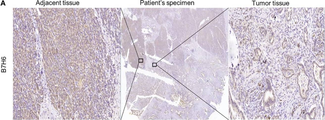 B7H6 expression in human pancreatic cancer tissues. (A) IHC staining of B7H6 in tumor (right) and adjacent tissues (left) of a pancreatic cancer patient’s specimens (magnification: Middle, 10×; right and left, 100×). (B) B7H6 expression in benign human organs shown by IHC staining of B7H6 (magnification: 100×). (C) Kaplan-Meier survival analysis of overall survival between PC patients who carried B7H6-positive or -negative tumors. P=0.017. (D) Kaplan-Meier analysis of overall survival between patients with high levels of B7H6 (H score ≥ 47) and those with low levels (H-score < 47). P<0.001. Image collected and cropped by CiteAb from the following open publication (//pubmed.ncbi.nlm.nih.gov/35311080), licensed under a CC-BY license. Not internally tested by R&D Systems.