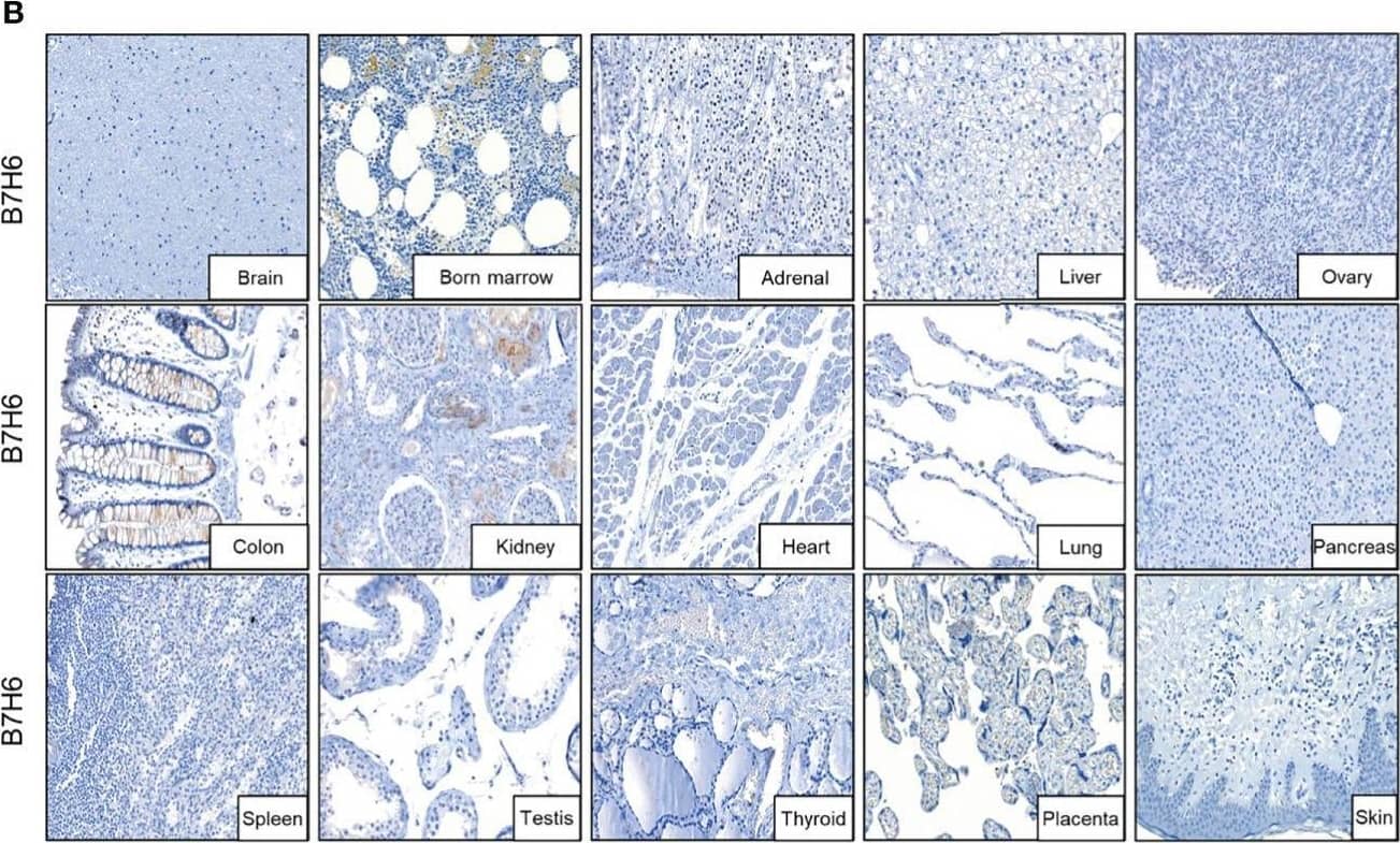 B7H6 expression in human pancreatic cancer tissues. (A) IHC staining of B7H6 in tumor (right) and adjacent tissues (left) of a pancreatic cancer patient’s specimens (magnification: Middle, 10×; right and left, 100×). (B) B7H6 expression in benign human organs shown by IHC staining of B7H6 (magnification: 100×). (C) Kaplan-Meier survival analysis of overall survival between PC patients who carried B7H6-positive or -negative tumors. P=0.017. (D) Kaplan-Meier analysis of overall survival between patients with high levels of B7H6 (H score ≥ 47) and those with low levels (H-score < 47). P<0.001. Image collected and cropped by CiteAb from the following open publication (//pubmed.ncbi.nlm.nih.gov/35311080), licensed under a CC-BY license. Not internally tested by R&D Systems.