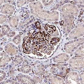 CD34 was detected in immersion fixed paraffin-embedded sections of human kidney using Mouse Anti-Human CD34 Monoclonal Antibody (Catalog # MAB72273) at 5 &micro;g/mL for 1 hour at room temperature followed by incubation with the Anti-Mouse IgG VisUCyte&trade; HRP Polymer Antibody (Catalog # VC001). Before incubation with the primary antibody, tissue was subjected to heat-induced epitope retrieval using VisUCyte Antigen Retrieval Reagent-Basic (Catalog # VCTS021). Tissue was stained using DAB (brown) and counterstained with hematoxylin (blue). Specific staining was localized to glomeruli. View our protocol for IHC Staining with VisUCyte HRP Polymer Detection Reagents.