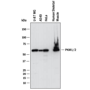 Western blot shows lysates of U‑87 MG human glioblastoma/astrocytoma cell line, A549 human lung carcinoma cell line, HeLa human cervical epithelial carcinoma cell line, human skeletal muscle. PVDF membrane was probed with 0.25 µg/mL of Mouse Anti-Human/Mouse/Rat PKM2 Monoclonal Antibody (Catalog # MAB72442) followed by HRP-conjugated Anti-Mouse IgG Secondary Antibody (HAF018). A specific band was detected for PKM2 at approximately 60 kDa (as indicated). This experiment was conducted under reducing conditions and using Western Blot Buffer Group 1.