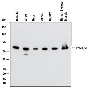 Western blot shows lysates of U‑87 MG human glioblastoma/astrocytoma cell line, A549 human lung carcinoma cell line, HeLa human cervical epithelial carcinoma cell line, Jurkat human acute T cell leukemia cell line, HepG2 human hepatocellular carcinoma cell line, human skeletal muscle. PVDF membrane was probed with 0.25 µg/mL of Mouse Anti-Human PKM2 Monoclonal Antibody (Catalog # MAB72443) followed by HRP-conjugated Anti-Mouse IgG Secondary Antibody (HAF018). A specific band was detected for PKM2 at approximately 60 kDa (as indicated). This experiment was conducted under reducing conditions and using Western Blot Buffer Group 1.
