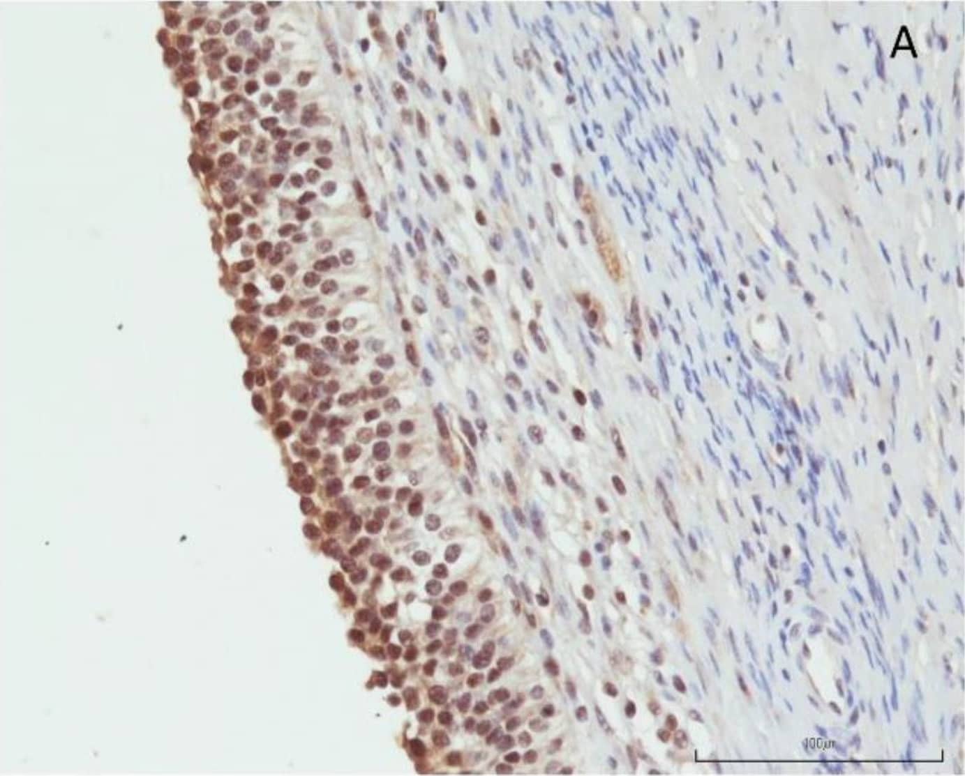 (A) Cytoplasmatic positivity for orexin B in granulosa cells (20X IHC). Scale bar = 100 µm. (B) Negative control. Image collected and cropped by CiteAb from the following open publication (//pubmed.ncbi.nlm.nih.gov/34204547), licensed under a CC-BY license. Not internally tested by R&D Systems.