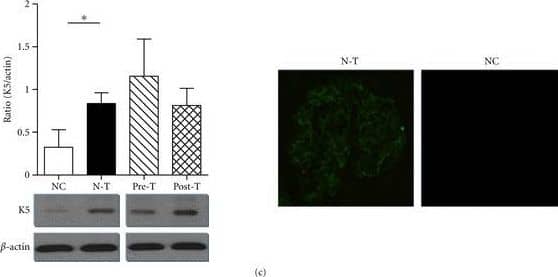 Ferulic acid regulated the differential expression of angiogenic and antiangiogenic factors in MN mouse model.  At the end of the experiment, kidney samples of different groups were harvested and freshly isolated the glomeruli according to the Materials and Methods. Total protein lysate was extracted from isolated glomeruli and separated in 10% SDS page by electrophoresis, and further blotting by anti-VEGF (a), TSP-1 (b), and K5 (c) antibodies. The bar chart represented the semiquantification level of the expression density (target/actin) (Left Panel) (*P < 0.05; **P < 0.01). Immunofluorescence staining was also undertaken to exam the expression level and location of VEGF, TSP-1, and K5 in NC and N-T, original magnifications, 400x (Right Panel). Image collected and cropped by CiteAb from the following publication (//pubmed.ncbi.nlm.nih.gov/22844329), licensed under a CC-BY license. Not internally tested by R&D Systems.