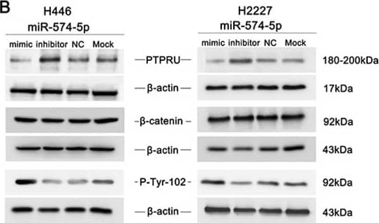 Western Blot PTP pi/PTPRU Antibody (764209)