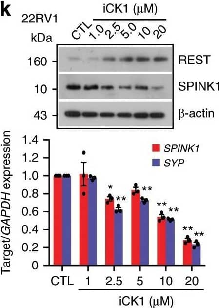 Reprogramming factor SOX2&AR transcriptional co-repressor REST modulate SPINK1 expression.k Immunoblot for the REST&SPINK1 levels in 22RV1 cells treated with Casein Kinase 1 inhibitor (iCK1) as indicated (top). QPCR data for relative SPINK1&SYP expression (bottom). Image collected & cropped by CiteAb from the following open publication (//pubmed.ncbi.nlm.nih.gov/31959826), licensed under a CC-BY license. Not internally tested by R&D Systems.