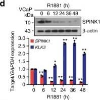 Androgen signaling negatively regulates SPINK1 expression in prostate cancer.a Immunoblot for SPINK1 in 22RV1 cells stimulated with R1881 (10 nM) (top). QPCR data showing relative expression of SPINK1&KLK3 in the same cells (bottom). b Immunostaining for SPINK1&AR in 22RV1 cells stimulated with R1881 (10 nM). c Same as b, except dot plot represents quantification for SPINK1 mean fluorescence intensity (MFI) per unit area shown as arbitrary units (AU). d Same as a, except VCaP cells used. Image collected & cropped by CiteAb from the following open publication (//pubmed.ncbi.nlm.nih.gov/31959826), licensed under a CC-BY license. Not internally tested by R&D Systems.