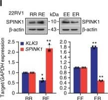 Androgen signaling negatively regulates SPINK1 expression in prostate cancer. l Immunoblot showing SPINK1 expression in 22RV1 cells as indicated in k (top). QPCR data showing relative expression of SPINK1&KLK3 using same cells in k (bottom)Image collected & cropped by CiteAb from the following open publication (//pubmed.ncbi.nlm.nih.gov/31959826), licensed under a CC-BY license. Not internally tested by R&D Systems.