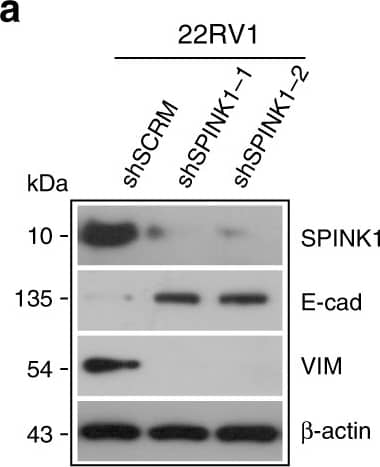 SPINK1 promotes EMT, stemness&chemoresistance in prostate cancer.a Immunoblot analysis for SPINK1, E-Cadherin&Vimentin levels in stable SPINK1-silenced (shSPINK1-1&shSPINK1-2)&control (shSCRM) 22RV1 cells. Image collected & cropped by CiteAb from the following open publication (//pubmed.ncbi.nlm.nih.gov/31959826), licensed under a CC-BY license. Not internally tested by R&D Systems.