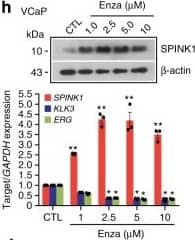 Androgen signaling negatively regulates SPINK1 expression in prostate cancer. h Immunoblot showing SPINK1 expression in VCaP cells treated with enzalutamide (top). QPCR data showing relative expression of SPINK1, KLK3,&ERG (bottom). Image collected & cropped by CiteAb from the following open publication (//pubmed.ncbi.nlm.nih.gov/31959826), licensed under a CC-BY license. Not internally tested by R&D Systems.