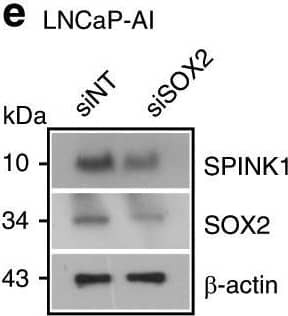 Reprogramming factor SOX2&AR transcriptional co-repressor REST modulate SPINK1 expression.a Schematic showing SOX2 binding elements (S1, S2,&S3) on the SPINK1 promoter (top). ChIP-qPCR data for SOX2 occupancy on the SPINK1 promoter in wildtype LNCaP&LNCaP-AI cells (androgen-deprived for 15 days) (bottom). b Same as in a, except 22RV1 cells. c ChIP-qPCR data for RNA Pol-II binding on the SPINK1 promoter using cells as a. d Same as c, except 22RV1 cells. e Immunoblot for SOX2&SPINK1 in siRNA mediated SOX2-silenced LNCaP-AI&control cells. Image collected & cropped by CiteAb from the following open publication (//pubmed.ncbi.nlm.nih.gov/31959826), licensed under a CC-BY license. Not internally tested by R&D Systems.