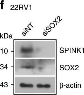 Reprogramming factor SOX2&AR transcriptional co-repressor REST modulate SPINK1 expression.a Schematic showing SOX2 binding elements (S1, S2,&S3) on the SPINK1 promoter (top). ChIP-qPCR data for SOX2 occupancy on the SPINK1 promoter in wildtype LNCaP&LNCaP-AI cells (androgen-deprived for 15 days) (bottom). b Same as in a, except 22RV1 cells. c ChIP-qPCR data for RNA Pol-II binding on the SPINK1 promoter using cells as a. d Same as c, except 22RV1 cells. e Immunoblot for SOX2&SPINK1 in siRNA mediated SOX2-silenced LNCaP-AI&control cells. f Same as e, except 22RV1 cells.Image collected & cropped by CiteAb from the following open publication (//pubmed.ncbi.nlm.nih.gov/31959826), licensed under a CC-BY license. Not internally tested by R&D Systems.