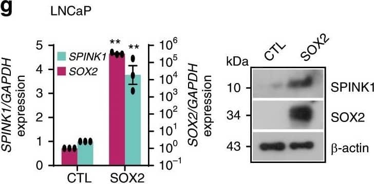 Reprogramming factor SOX2&AR transcriptional co-repressor REST modulate SPINK1 expression.a Schematic showing SOX2 binding elements (S1, S2,&S3) on the SPINK1 promoter (top). ChIP-qPCR data for SOX2 occupancy on the SPINK1 promoter in wildtype LNCaP&LNCaP-AI cells (androgen-deprived for 15 days) (bottom). b Same as in a, except 22RV1 cells. c ChIP-qPCR data for RNA Pol-II binding on the SPINK1 promoter using cells as a. d Same as c, except 22RV1 cells. e Immunoblot for SOX2&SPINK1 in siRNA mediated SOX2-silenced LNCaP-AI&control cells. f Same as e, except 22RV1 cells. g QPCR data showing relative expression of SOX2&SPINK1 upon transient SOX2 overexpression in LNCaP cells (left). Immunoblot for SOX2&SPINK1 expression(right). Image collected & cropped by CiteAb from the following open publication (//pubmed.ncbi.nlm.nih.gov/31959826), licensed under a CC-BY license. Not internally tested by R&D Systems.