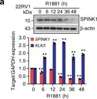 Androgen signaling negatively regulates SPINK1 expression in prostate cancer.a Immunoblot for SPINK1 in 22RV1 cells stimulated with R1881 (10 nM) (top). QPCR data showing relative expression of SPINK1&KLK3 in the same cells (bottom). Image collected & cropped by CiteAb from the following open publication (//pubmed.ncbi.nlm.nih.gov/31959826), licensed under a CC-BY license. Not internally tested by R&D Systems.