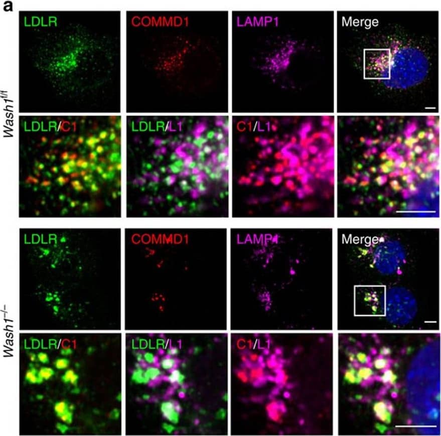 COMMD1 deficiency impairs the function of LDLR.(a) LDLR (green), COMMD1 (red) and VPS35 (pink) were stained in Commd1f/f and Commd1−/− MEFs and imaged by confocal microscopy. Representative images are shown; scale bar, 5μm. (b) Quantification of the colocalization of LDLR with COMMD1, VPS35, EEA1 and LAMP1 was performed by the analysis of 30–40 cells. (c) Total and plasma membrane LDLR levels of Commd1f/f and Commd1−/− MEFs determined by biotinylation assay. Data represent three independent experiments, and (d) the relative levels of LDLR at the cell surface are quantified in all experiments. (e) In vitro LDL and transferrin uptake assay. Dil-labelled LDL (5 μg ml−1) or Alexa-633-labelled transferrin (5 μg ml−1) was added to serum-depleted medium and incubated with MEFs at 4 °C for 1 h and subsequently at 37 °C for 5 min. Dil-labelled LDL and Alexa-633-labelled transferrin uptake was measured by FACS analysis, and the relative uptake in triplicate is shown. The results are presented as mean±s.e.m.; significance was calculated relative to the control group by unpaired Student's t-test; *P30 cells per condition were recorded. The results are presented as mean±s.e.m.; significance was calculated relative to the control group by unpaired Student's t-test; ***P<0.001. Image collected and cropped by CiteAb from the following publication (//www.nature.com/articles/ncomms10961), licensed under a CC-BY license. Not internally tested by R&D Systems.