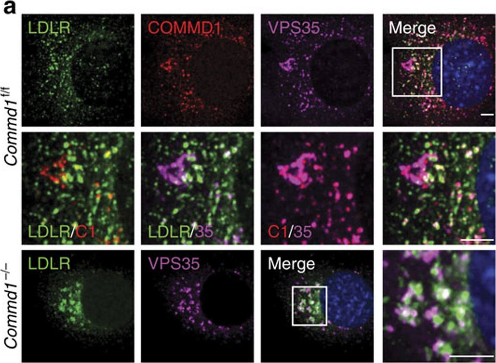 COMMD1 deficiency impairs the function of LDLR.(a) LDLR (green), COMMD1 (red) and VPS35 (pink) were stained in Commd1f/f and Commd1−/− MEFs and imaged by confocal microscopy. Representative images are shown; scale bar, 5μm. (b) Quantification of the colocalization of LDLR with COMMD1, VPS35, EEA1 and LAMP1 was performed by the analysis of 30–40 cells. (c) Total and plasma membrane LDLR levels of Commd1f/f and Commd1−/− MEFs determined by biotinylation assay. Data represent three independent experiments, and (d) the relative levels of LDLR at the cell surface are quantified in all experiments. (e) In vitro LDL and transferrin uptake assay. Dil-labelled LDL (5 μg ml−1) or Alexa-633-labelled transferrin (5 μg ml−1) was added to serum-depleted medium and incubated with MEFs at 4 °C for 1 h and subsequently at 37 °C for 5 min. Dil-labelled LDL and Alexa-633-labelled transferrin uptake was measured by FACS analysis, and the relative uptake in triplicate is shown. The results are presented as mean±s.e.m.; significance was calculated relative to the control group by unpaired Student's t-test; *P<0.05, ***P<0.001. Image collected and cropped by CiteAb from the following publication (//www.nature.com/articles/ncomms10961), licensed under a CC-BY license. Not internally tested by R&D Systems.