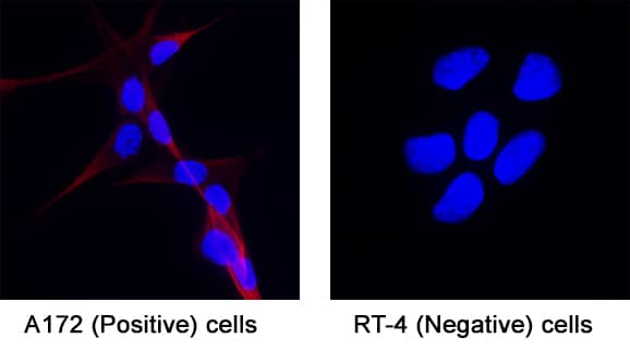Caspr1 was detected in immersion fixed A172 human glioblastoma cell line (Positive) & RT‑4 human urinary bladder transitional cell papilloma cell line (Negative) using Mouse Anti-Human Caspr1 Monoclonal Antibody (Catalog # MAB7548) at 8 &micro;g/mL for 3 hours at room temperature. Cells were stained using the NorthernLights&trade; 557-conjugated Anti-Mouse IgG Secondary Antibody (red; Catalog # NL007) and counterstained with DAPI (blue). Specific staining was localized to Cell surface and cytoplasm. View our protocol for Fluorescent ICC Staining of Cells on Coverslips.