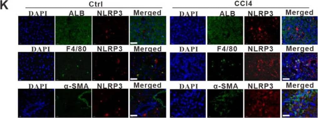 NLRP3 inflammasome-dependent pyroptosis occurs in liver fibrosis. (A) IHC staining for GSDMD, IL-1 beta , and IL-18 in liver sections from liver fibrosis patients and HCs. Scale bar: 40 µm. (B–D) ELISA analyses of serum levels of GSDMD (B), IL-1 beta  (C), and IL-18 (D) in liver fibrosis patients (n = 89) and HCs (n = 60). (E) Representative immunofluorescence images of NLRP3 (red) and albumin (hepatocyte marker) (top), F4/80 (KC marker) (middle) or  alpha -SMA (HSC marker) (bottom) (green) from the human fibrotic liver tissues. Scale bar: 40 µm. (F) Schematic diagram of the study. Liver fibrosis was induced by CCl4 injection for 8 weeks. (G) Representative mouse liver histology of H&E, Sirius Red staining, and IHC staining for  alpha -SMA, GSDMD, and IL-1 beta . Black scale bar: 100 µm; Red scale bar: 50 µm. (H–J) ELISA analyses for serum levels of GSDMD (H), IL-1 beta  (I), and IL-18 (J) in CCl4 group mouse (n = 5) and vehicle group mouse (n = 5). (K) Representative immunofluorescence images of NLRP3 (red) and albumin (hepatocyte marker) (top), F4/80 (KC marker) (middle) or  alpha -SMA (HSC marker) (bottom) (green) from the 8-week CCl4-treated mouse liver. The vehicle group mouse liver was used as a control. Scale bar: 40 µm. (L) The qRT-PCR analysis for mRNA levels of IL-1 beta  in THP-1 macrophages treated with LPS to induce pyroptosis. (M) ELISA analysis for IL-1 beta  expression in supernatants from THP-1. (N) Western blot analysis of COL1A1,  alpha -SMA, and TGF-beta  expression in LX-2 cells which were exposed to CM from LPS-treated THP-1 macrophages. The protein expression was quantified by densitometry and normalized to  beta -actin and are shown as fold changes relative to the control group (right panel). ** p < 0.01, *** p < 0.001. Image collected and cropped by CiteAb from the following open publication (//pubmed.ncbi.nlm.nih.gov/36429008), licensed under a CC-BY license. Not internally tested by R&D Systems.