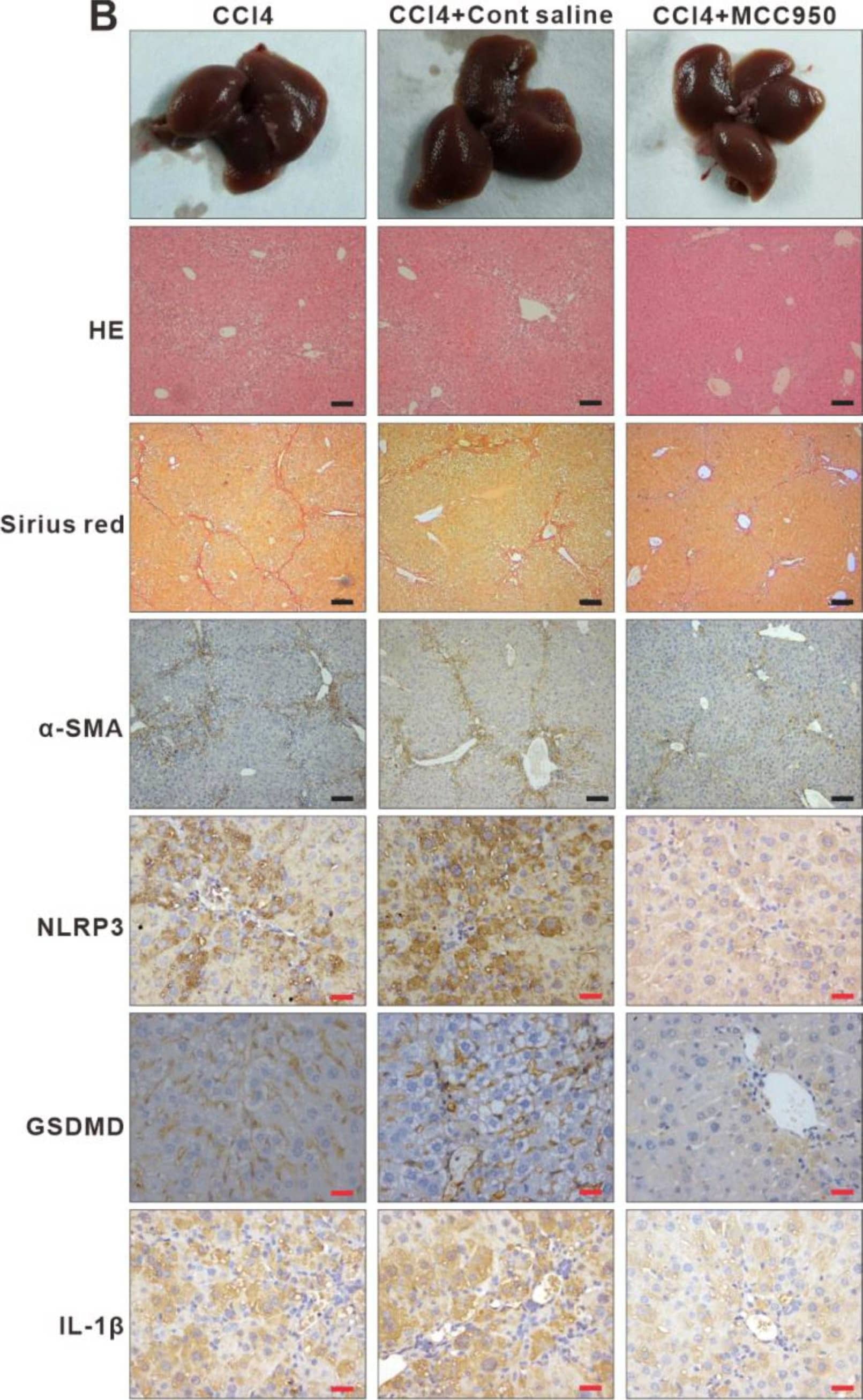 Inhibition of NLRP3 inflammasome-dependent pyroptosis alleviates liver fibrosis progression. (A) Experimental protocol of NLRP3 inhibitor MCC950 or saline application based on CCl4 injection in mice. (B) Representative liver histology of H&E and Sirius Red staining. The expression of  alpha -SMA, NLRP3, GSDMD, and IL-1 beta  was determined by immunohistochemistry. Black scale bar: 100 µm; Red scale bar: 50 µm. (C–E) Serum levels of ALT, AST, and TP were measured. * p < 0.05. Image collected and cropped by CiteAb from the following open publication (//pubmed.ncbi.nlm.nih.gov/36429008), licensed under a CC-BY license. Not internally tested by R&D Systems.