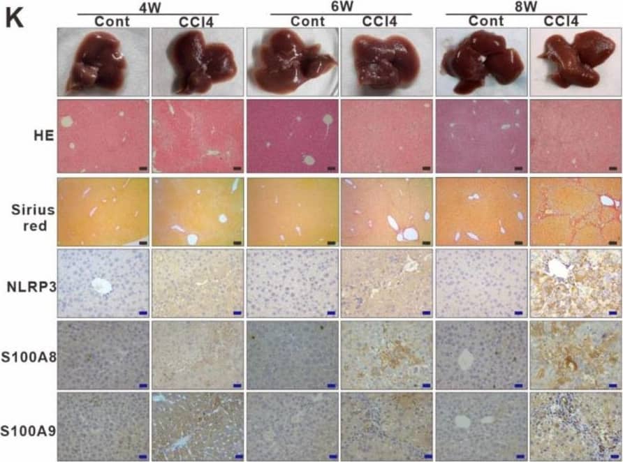 DAMP S100A8 along with NLRP3 inflammasome-dependent pyroptosis is positively related to the progression of liver fibrosis. (A) Representative IHC images for S100A8 and S100A9 in liver sections from liver fibrosis patients and HCs. (B,C) ELISA analyses for serum levels of S100A8 and S100A9 in liver fibrosis patients and HCs. (D) Comparison of serum S100A8 and S100A9 levels in liver fibrosis patients with different phases. (E–G) Distribution of serum GSDMD (E), IL-1 beta  (F), and IL-18 (G) levels in liver fibrosis patients with different phases (F0–4). (H–J) Correlation between serum S100A8 levels and GSDMD (H), IL-1 beta  (I) or IL-18 (J) levels in liver fibrosis patients. (K) Representative mouse liver morphology and staining with H&E and Sirius Red. (L–O) IHC staining of mouse liver sections for NLRP3, S100A8, and S100A9. Black scale bar: 100 µm; Red scale bar: 50 µm. ELISA analyses for serum levels of S100A8 (L), GSDMD (M), IL-1 beta  (n), and IL-18 (O) in 4-, 6-, and 8 week-mouse models of liver fibrosis. *** p < 0.001. Image collected and cropped by CiteAb from the following open publication (//pubmed.ncbi.nlm.nih.gov/36429008), licensed under a CC-BY license. Not internally tested by R&D Systems.