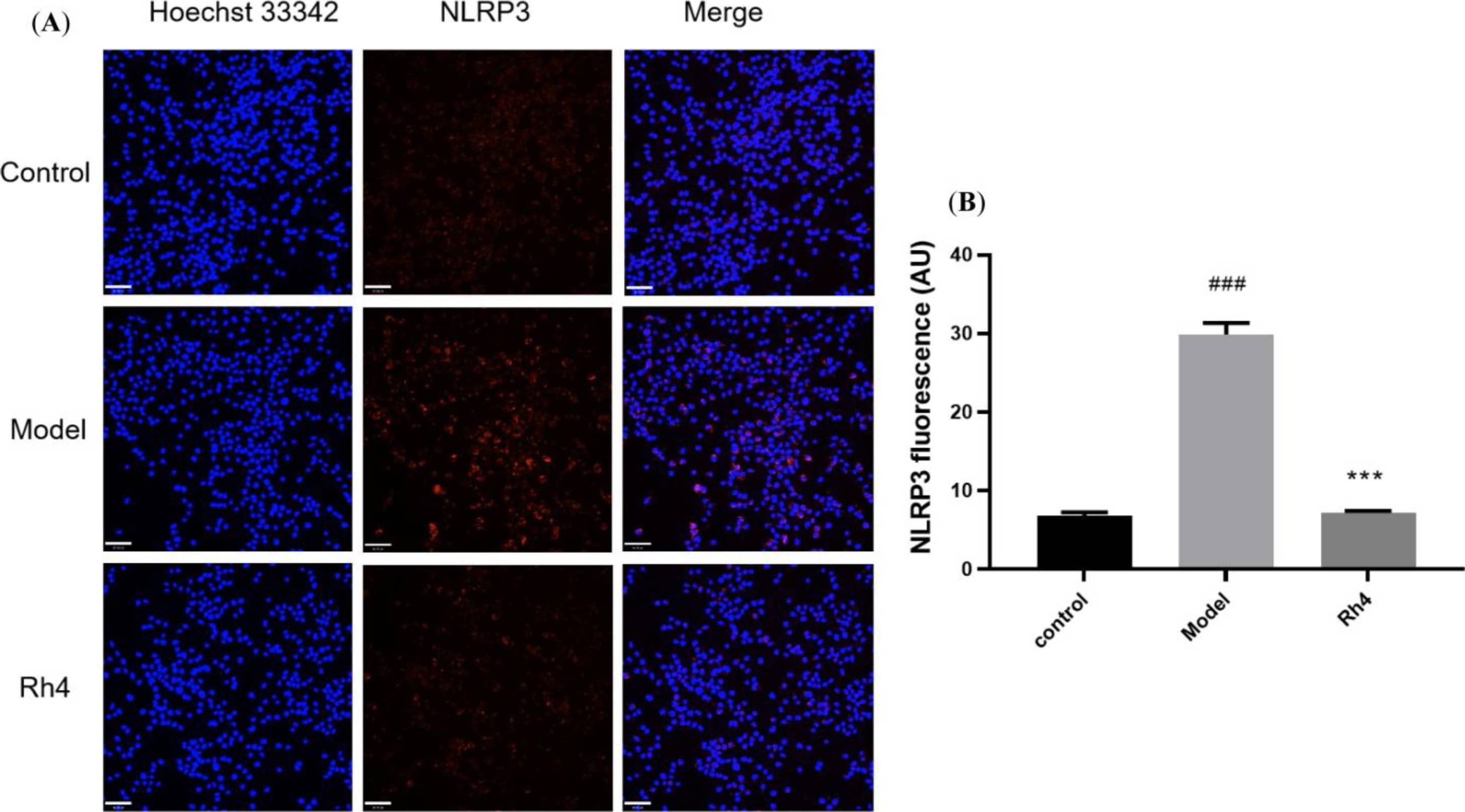 Effect of ginsenoside Rh4 on NLRP3 expression in LPS and nigericin-induced microglia cells. (A): NLRP3 (red) and nuclei (blue) using a laser confocal microscope; (B): Quantitative analysis of NLRP3 fluorescence intensity. Scale bars, 70 μm. The bar represents the mean ± standard error of the mean (n = 3). The Student’s t-test determined significant differences (### p < 0.001 compared with normal cells, *** p < 0.001 with LPS and nigericin-treated cells). Image collected and cropped by CiteAb from the following open publication (//pubmed.ncbi.nlm.nih.gov/37239965), licensed under a CC-BY license. Not internally tested by R&D Systems.