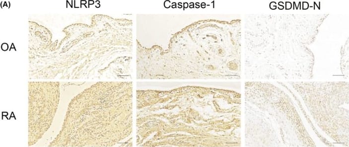 Expression of NLRP3, caspase‐1 and gasdermin D‐N‐terminal (GSDMD‐N) in synovial tissues from patients with osteoarthritis (OA) or rheumatoid arthritis (RA). (A) Sections were stained with antibodies against the indicated proteins. Scale bar, 100 μm. (B) Sections were stained with an antibody against the macrophage marker CD68 and another antibody against a pyroptosis‐related marker. Nuclei were counterstained with DAPI. Scale bar, 50 μm. Image collected and cropped by CiteAb from the following open publication (//pubmed.ncbi.nlm.nih.gov/37386795), licensed under a CC-BY license. Not internally tested by R&D Systems.