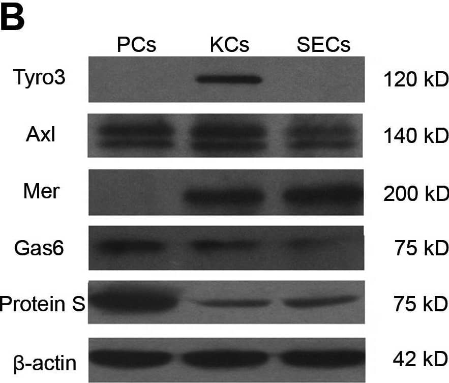 Expression of TAM RTKs, Gas6 and Protein S.(A) Western blot analyses of the liver lysates for the examination of TAM RTKs, Gas6 and Protein S. (B) Expression of TAM RTKs, Gas6 and Protein S in isolated liver cells: parenchymal cells (PCs), Kupffer cells(KCs) and sinusoidal endothelial cells (SECs). The primary cells were subjected to Western blotting. (C) Immunohistochemistry for the detection of TAM RTKs, Gas6 and Protein S. Arrowheads indicate PCs, and arrows indicate spindle-shaped sinusoidal cells corresponding to KCs and SECs. In negative controls (islets), sections were incubated with primary antibodies pre-incubated with an excess of blocking peptide. The livers of 15-week-old WT mice were used for the protein analyses. The images are representatives of at least three experiments. Scale bar  = 20 µm. Image collected and cropped by CiteAb from the following open publication (//pubmed.ncbi.nlm.nih.gov/23799121), licensed under a CC-BY license. Not internally tested by R&D Systems.