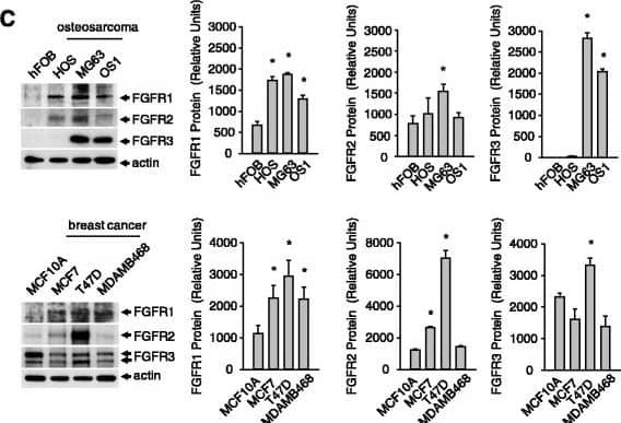 Expression of FGFR1 in cells from breast and bone tissue. a, FGFR mRNA transcript levels in normal and cancer cells. b, Fold change in FGFR mRNA based on expression in cancers cells relative to normal cells. c, FGFR protein levels in normal versus cancer cells. Results are from triplicate experiments and the Western blot is representative of the triplicates. (*p < 0.05) Image collected and cropped by CiteAb from the following open publication (//pubmed.ncbi.nlm.nih.gov/26201468), licensed under a CC-BY license. Not internally tested by R&D Systems.