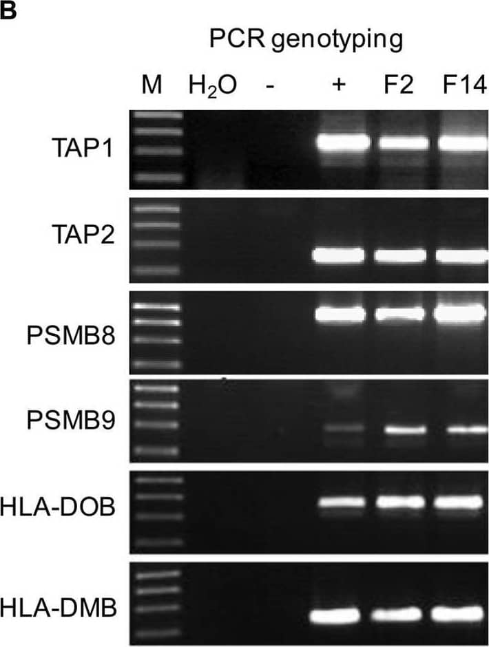 Generation of hTAP-LMP transgenic mice.(A) Schematic map of the BAC clone RP11-10A19. (B) PCR genotyping of the founder mice. F2 and F14 were the two positive founder mice. “−”, tail DNA samples of WT littermates; “+”, plasmid DNA of the BAC clone RP11-10A19. (C) Relative mRNA expression of human TAP1, TAP2, PSMB8, and PSMB9 in splenocytes from WT or hTAP-LMP mice as analyzed by qRT-PCR and normalized to 18S rRNA levels. (D) Expression of human TAP1 (65 kDa), TAP2 (75 kDa), PSMB8 (23/28 kDa), and PSMB9 (22 kDa) in WT or hTAP-LMP mice was determined by western blotting;  beta -actin (42 kDa) was used as an internal control. (E) FACS analysis for CD4 and CD8 expression of splenocytes from WT and hTAP-LMP mice (up), with the percentage of CD4+ T cells (below, left) and CD8+ T cells (below, right). PCR genotyping and western blotting were performed on individual mice, and the depicted results are representative of at least three independent experiments. Full-length PCR gels and Western blots are presented in Supplementary Figs S6 and S7, respectively. Results of the qRT-PCR and FACS analysis are representative of at least three independent experiments with n ≥ 3. Data represent the mean ± SD. ns, not significant. Image collected and cropped by CiteAb from the following open publication (//pubmed.ncbi.nlm.nih.gov/27634283), licensed under a CC-BY license. Not internally tested by R&D Systems.