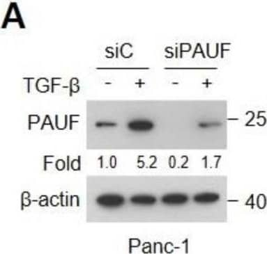 Western Blot PAUF/ZG16B Antibody (817310) [Unconjugated]