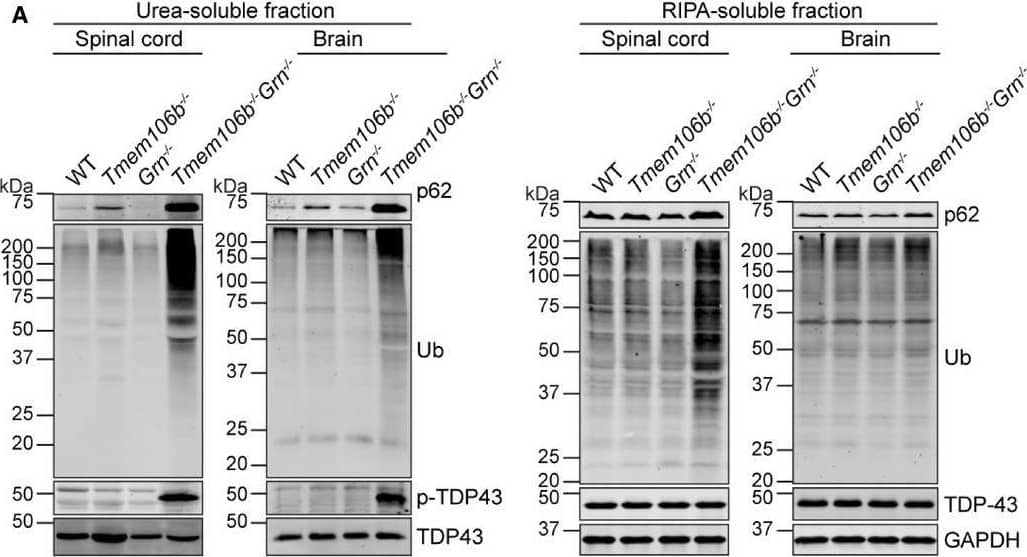 FTLD‐related pathological changes in Tmem106b−/−Grn−/− miceA, BWestern blot analysis of p62, ubiquitin (Ub), TDP‐43 and p‐TDP-43 in RIPA‐ and urea‐soluble fractions from spinal cord (C5–C8) and brain of 5‐month‐old WT, Tmem106b−/−, Grn−/−, and Tmem106b−/−Grn−/− mice. Spinal cord: n = 3; brain: n = 4. Data presented as mean ± SEM. One‐way ANOVA tests with Bonferroni's multiple comparisons: *P < 0.05; **P < 0.01, ***P < 0.001, ****P < 0.0001.C, DImmunostaining of p62 and ubiquitin in the spinal cord sections from 5‐month‐old WT, Tmem106b−/−, Grn−/−, and Tmem106b−/−Grn−/− mice. The number of p62 or Ub positive puncta was quantified. n = 3. Data presented as mean ± SEM. One‐way ANOVA tests with Bonferroni's multiple comparisons: ***P < 0.001, ****P < 0.0001. Scale bar = 10 μm.Source data are available online for this figure. Image collected and cropped by CiteAb from the following open publication (//pubmed.ncbi.nlm.nih.gov/32852886), licensed under a CC-BY license. Not internally tested by R&D Systems.