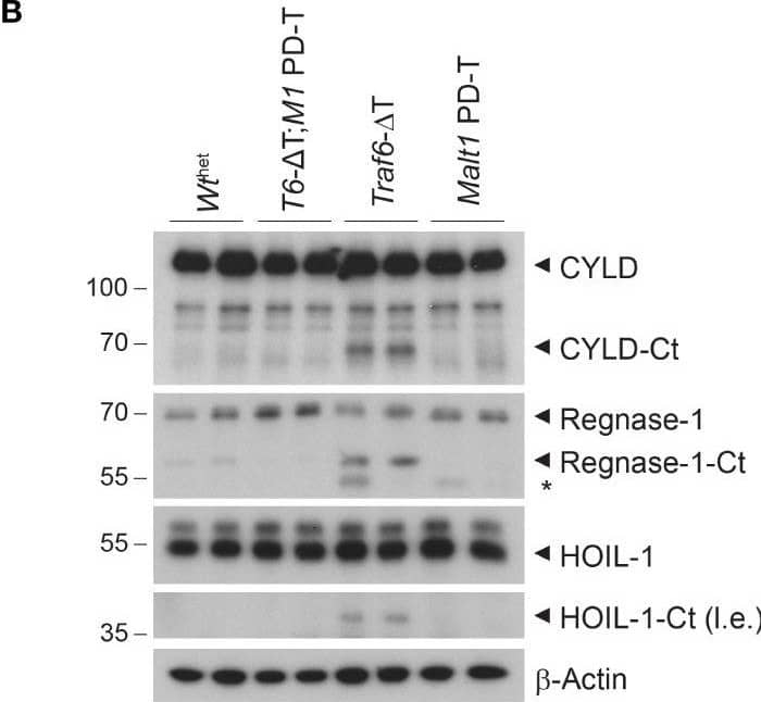 Effects of single or combined TRAF6 KO and MALT1 paracaspase mutation on signaling in CD4+ T cells. (A) Schematic overview of the four conditional mouse strains used in the analyses. (B) Western blots showing MALT1 substrate cleavage in unstimulated purified CD4+ T cells from Wthet, T6-delta T;M1 PD-T, Traf6-delta T and Malt1 PD-T mice (two independent mice each). Asterisks indicate unspecific signals. (C) Analyses of NF-kappa B activation (EMSA), p65 phosphorylation and MALT1 substrate cleavage (Western blot, WB) in PMA/Ionomycin (P/I) stimulated purified CD4+ T cells of mice as depicted in (A). (D) Expression of ICOS on CD4+ and CD8+ T cells by flow cytometric analysis of spleen of mice as depicted in (A). Bars show the means ± SEM, and P values were calculated by one-way ANOVA with Tukey’s multiple comparison test. All analyses were performed with mice 9-11 weeks of age. Each dot represents one mouse. Ct, C-terminus; l.e., long exposure. Image collected and cropped by CiteAb from the following open publication (//pubmed.ncbi.nlm.nih.gov/36761777), licensed under a CC-BY license. Not internally tested by R&D Systems.