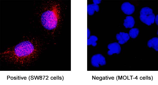 Neurogranin was detected in immersion fixed SW480 human liposarcoma cell line (positive staining) and MOLT‑4 human acute lymphoblastic leukemia cell line using Mouse Anti-Human Neurogranin Monoclonal Antibody (Catalog # MAB79471) at 8 &micro;g/mL for 3 hours at room temperature. Cells were stained using the NorthernLights&trade; 557-conjugated Anti-Mouse IgG Secondary Antibody (red; NL007) and counterstained with DAPI (blue). Specific staining was localized to cytoplasm. Staining is performed using our protocol for Fluorescent ICC Staining of Non-adherent Cells.