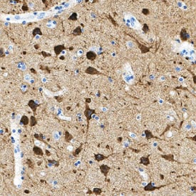 Neurogranin was detected in immersion fixed paraffin-embedded sections of human brain (cortex) using Mouse Anti-Human Neurogranin Monoclonal Antibody (Catalog # MAB79471) at 5 &micro;g/mL for 1 hour at room temperature followed by incubation with the Anti-Mouse IgG VisUCyte&trade; HRP Polymer Antibody (Catalog # VC001). Before incubation with the primary antibody, tissue was subjected to heat-induced epitope retrieval using Antigen Retrieval Reagent-Basic (Catalog # CTS013). Tissue was stained using DAB (brown) and counterstained with hematoxylin (blue). Specific staining was localized to cytoplasm in neurons. View our protocol for IHC Staining with VisUCyte HRP Polymer Detection Reagents.