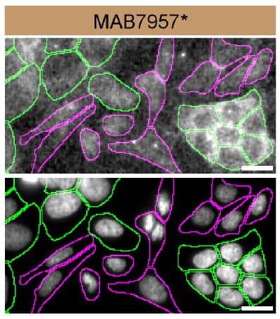 HAP1 WT and Casein Kinase 2 alpha KO cells were labelled with a green or a far-red fluorescent dye, respectively. Cells were stained with Mouse Anti-Human Casein Kinase 2 alpha Monoclonal Antibody (Catalog # MAB7957) followed by incubation with a goat anti-mouse Alexa-fluor 555 coupled secondary antibody (upper panel). DAPI-only counterstained cells shown on a lower panel. Acquisition of the blue (nucleus-DAPI), green (identification of WT cells), red (antibody staining) and far-red (identification of KO cells) channels was performed. Representative images of the blue and red (grayscale) channels are shown. WT and KO cells are outlined with green and magenta dashed line, respectively. Primary antibody concentration used: 1 µg/mL. Image, protocol and testing courtesy of YCharOS Inc. (ycharos.com).