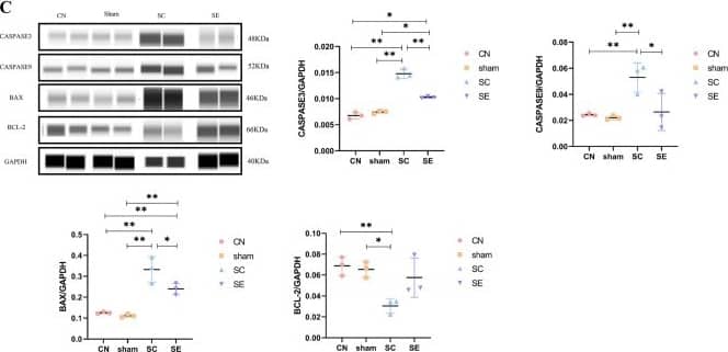 TUNEL assay of cardiac myocyte apoptosis in the hearts. (A) Quantification of TUNEL-positive nuclei n=3. Representative qPCR (B) and western blot (C) analysis (original blots/gels are presented in Supplementary 2 Fig.7-9) of apoptosis-related mRNA and protein, n=3, Chemiluminescence signals were visualized and cropped using Protein Simple Compass software. The whole cell lysates were used for western blot. The data are presented as the mean SEM; *P<0.05; **P<0.01. Image collected and cropped by CiteAb from the following publication (//pubmed.ncbi.nlm.nih.gov/40188200/), licensed under a CC-BY license. Not internally tested by Novus Biologicals.