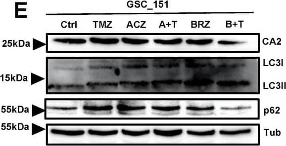 The combination of BRZ and TMZ increased cell death in GBM stem-like cells by activating autophagy (A,B) Autophagy marker LC3 immunostaining of U251_Ctrl and U251_CA2 cells after TMZ and ACZ/BRZ stimulation for 24 h. Co-treatment with TMZ and BRZ induced the expression of LC3 puncta in U251_CA2 cells (scale bar: 50 μm). (C,D) Western Blotting of autophagy-related proteins and CA2 protein in U251_Ctrl and U251_CA2 cells with the same treatment as in (A). TMZ plus BRZ did not increase the protein expression of LC3II in U251_Ctrl cells compared to TMZ treatment alone (C) but increased in U251_CA2 cells (D) (n = 3). (E–G) Western Blotting of autophagy-related proteins and CA2 protein in GBM stem cells with the same treatment as in Figure 5E–G for 24 h stimulation. Compared with the control group, TMZ monotherapy has a tendency to increase the protein level of LC3II, but the expression of it is significantly increased in BRZ alone and TMZ combined with BRZ treatment (n = 3). Results were obtained from three independent experiments. Data are presented as mean ± SEM, One-way ANOVA was used to analyze the data, * p < 0.05; ** p < 0.01; *** p < 0.001, ns: not significant. Image collected and cropped by CiteAb from the following open publication (//pubmed.ncbi.nlm.nih.gov/35008590), licensed under a CC-BY license. Not internally tested by R&D Systems.