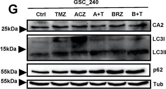 The combination of BRZ and TMZ increased cell death in GBM stem-like cells by activating autophagy (A,B) Autophagy marker LC3 immunostaining of U251_Ctrl and U251_CA2 cells after TMZ and ACZ/BRZ stimulation for 24 h. Co-treatment with TMZ and BRZ induced the expression of LC3 puncta in U251_CA2 cells (scale bar: 50 μm). (C,D) Western Blotting of autophagy-related proteins and CA2 protein in U251_Ctrl and U251_CA2 cells with the same treatment as in (A). TMZ plus BRZ did not increase the protein expression of LC3II in U251_Ctrl cells compared to TMZ treatment alone (C) but increased in U251_CA2 cells (D) (n = 3). (E–G) Western Blotting of autophagy-related proteins and CA2 protein in GBM stem cells with the same treatment as in Figure 5E–G for 24 h stimulation. Compared with the control group, TMZ monotherapy has a tendency to increase the protein level of LC3II, but the expression of it is significantly increased in BRZ alone and TMZ combined with BRZ treatment (n = 3). Results were obtained from three independent experiments. Data are presented as mean ± SEM, One-way ANOVA was used to analyze the data, * p < 0.05; ** p < 0.01; *** p < 0.001, ns: not significant. Image collected and cropped by CiteAb from the following open publication (//pubmed.ncbi.nlm.nih.gov/35008590), licensed under a CC-BY license. Not internally tested by R&D Systems.