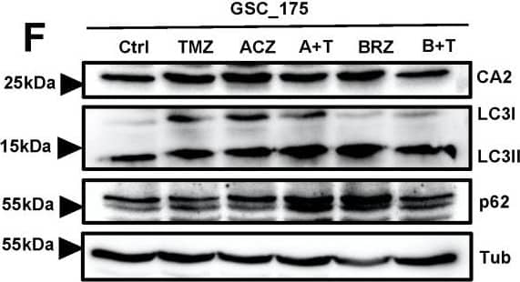 The combination of BRZ and TMZ increased cell death in GBM stem-like cells by activating autophagy (A,B) Autophagy marker LC3 immunostaining of U251_Ctrl and U251_CA2 cells after TMZ and ACZ/BRZ stimulation for 24 h. Co-treatment with TMZ and BRZ induced the expression of LC3 puncta in U251_CA2 cells (scale bar: 50 μm). (C,D) Western Blotting of autophagy-related proteins and CA2 protein in U251_Ctrl and U251_CA2 cells with the same treatment as in (A). TMZ plus BRZ did not increase the protein expression of LC3II in U251_Ctrl cells compared to TMZ treatment alone (C) but increased in U251_CA2 cells (D) (n = 3). (E–G) Western Blotting of autophagy-related proteins and CA2 protein in GBM stem cells with the same treatment as in Figure 5E–G for 24 h stimulation. Compared with the control group, TMZ monotherapy has a tendency to increase the protein level of LC3II, but the expression of it is significantly increased in BRZ alone and TMZ combined with BRZ treatment (n = 3). Results were obtained from three independent experiments. Data are presented as mean ± SEM, One-way ANOVA was used to analyze the data, * p < 0.05; ** p < 0.01; *** p < 0.001, ns: not significant. Image collected and cropped by CiteAb from the following open publication (//pubmed.ncbi.nlm.nih.gov/35008590), licensed under a CC-BY license. Not internally tested by R&D Systems.