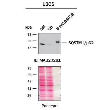Immunoprecipitation p62/SQSTM1 Antibody (864807) [Unconjugated]