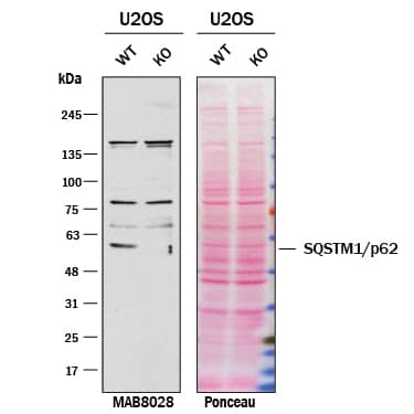 Knockout Validated p62/SQSTM1 Antibody (864807) [Unconjugated]