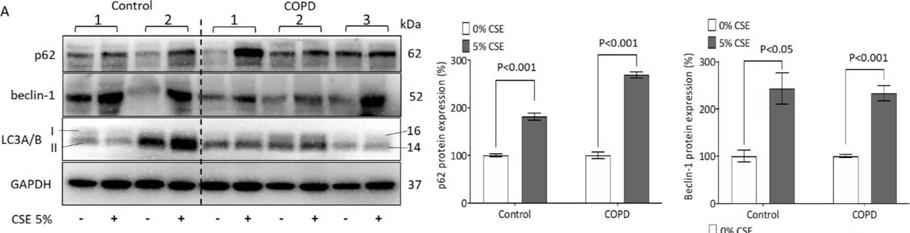 CSE induces autophagy in ASMCs. (A) Representative Western blots and image analysis of CSE-induced p62, beclin-1, and LC3A/B protein expression. GAPDH served as reference protein and p < 0.05 was considered significant. (B) Representative confocal microscopy on mitochondria-LC3 co-localization (white arrow) after CSE-stimulation (60×, green: cytochrome C, red: LC3A/B, blue: DAPI). Statistics were calculated by Mann–Whitney U-test. Image collected and cropped by CiteAb from the following open publication (//pubmed.ncbi.nlm.nih.gov/36430467), licensed under a CC-BY license. Not internally tested by R&D Systems.