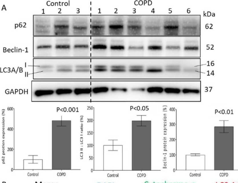 CSE modulates mitochondrial homeostasis by mitophagy and lysosome activity. (A) Representative Western blots and image analysis of p62, beclin-1, and LC3A/B protein of control and COPD ASMCs; GAPDH served as reference protein; p < 0.05 was considered significant. Statistics were calculated by Student’s t-test. (B) Representative confocal microscopy of co-localization mitochondria-LC3 (60×, green: cytochrome C, red: LC3A/B, blue: DAPI, white arrow shows co-localization). (C) Representative Western blots and image analysis of EEA1 and LAMP-1 protein of control and COPD ASMCs; GAPDH was used as reference protein, p < 0.05 was considered significant. Statistics were calculated by Student’s t-test. (D), Representative confocal microscopy of mitochondria–lysosome co-localization (60×, red: TOMM20, green: LAMP1, blue: DAPI, white arrow shows co-localization. Image collected and cropped by CiteAb from the following open publication (//pubmed.ncbi.nlm.nih.gov/36430467), licensed under a CC-BY license. Not internally tested by R&D Systems.