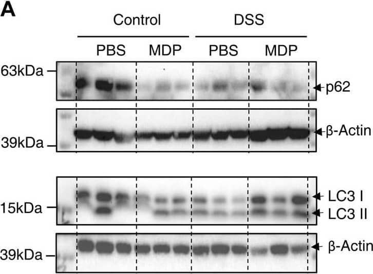 MDP activates autophagy in colon of DSS-induced mice. (A) Western blotting analysis for p62, LC3 І, and LC3 ІІ with  beta -Actin as the internal standard protein in the colon of PBS, MDP, DSS + PBS, and DSS + MDP group mice. Representative images of three duplicate samples of the immune blotting were shown. (B–D) Quantification of the relative expression of p62, LC3 І and LC3 ІІ in panel (A) by ImageJ, respectively. Data were expressed as mean ± SEM. *p <0.05, **p <0.01, ns, not significant, One-way ANOVA. Image collected and cropped by CiteAb from the following open publication (//pubmed.ncbi.nlm.nih.gov/36506547), licensed under a CC-BY license. Not internally tested by R&D Systems.
