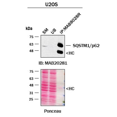 Immunoprecipitation was performed on cell lysate of U2OS human osteosarcoma cell line using 1.0 μg of Mouse Anti-Human SQSTM1/p62 Monoclonal Antibody (Catalog # MAB8028R) pre-coupled to protein G or protein A beads.  Immunoprecipitated SQSTM1/p62 was detected with Rabbit Anti-SQSTM1/p62 Monoclonal Antibody (Catalog # MAB80281). The Ponceau stained transfers of each blot are shown. SM=10% starting material; UB=10% unbound fraction; IP=immunoprecipitated.  Image, protocol, and testing courtesy of YCharOS Inc. (ycharos.com).