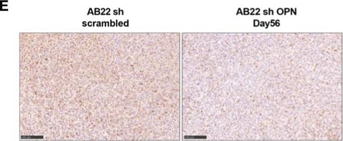 Silencing of OPN impairs the growth of AB22 cells in vivo. (A, B)In vivo growth of 5x104 AB22 sh- scrambled or AB22 shOPN, injected intra-thoracically in BALB/c mice. (A) IVIS in vivo imaging luminescence signal, mean+/-SEM values of 5 mice for sh-scrambled, 5 for shOPN; (B) luminescence signal values of each single mouse. (C) Histological quantification of number of tumor foci, and (D) total tumor area. Data are shown as mean +/- SEM; (A, B Two-way ANOVA; C, D: One-way ANOVA; E: Unpaired t test with Welch’s correction). E, F) immunohistochemistry for OPN in explanted tumors and representative pictures, bars represent 100 µm. (G) Representative pictures of explanted lungs from mice bearing control AB22 sh-scrambled cells (left), AB22 shOPN cells at day 17 (middle) and AB22 shOPN cells at day 56 (right). Bars represent 2.5 mm. Image collected and cropped by CiteAb from the following open publication (//pubmed.ncbi.nlm.nih.gov/37398648), licensed under a CC-BY license. Not internally tested by R&D Systems.