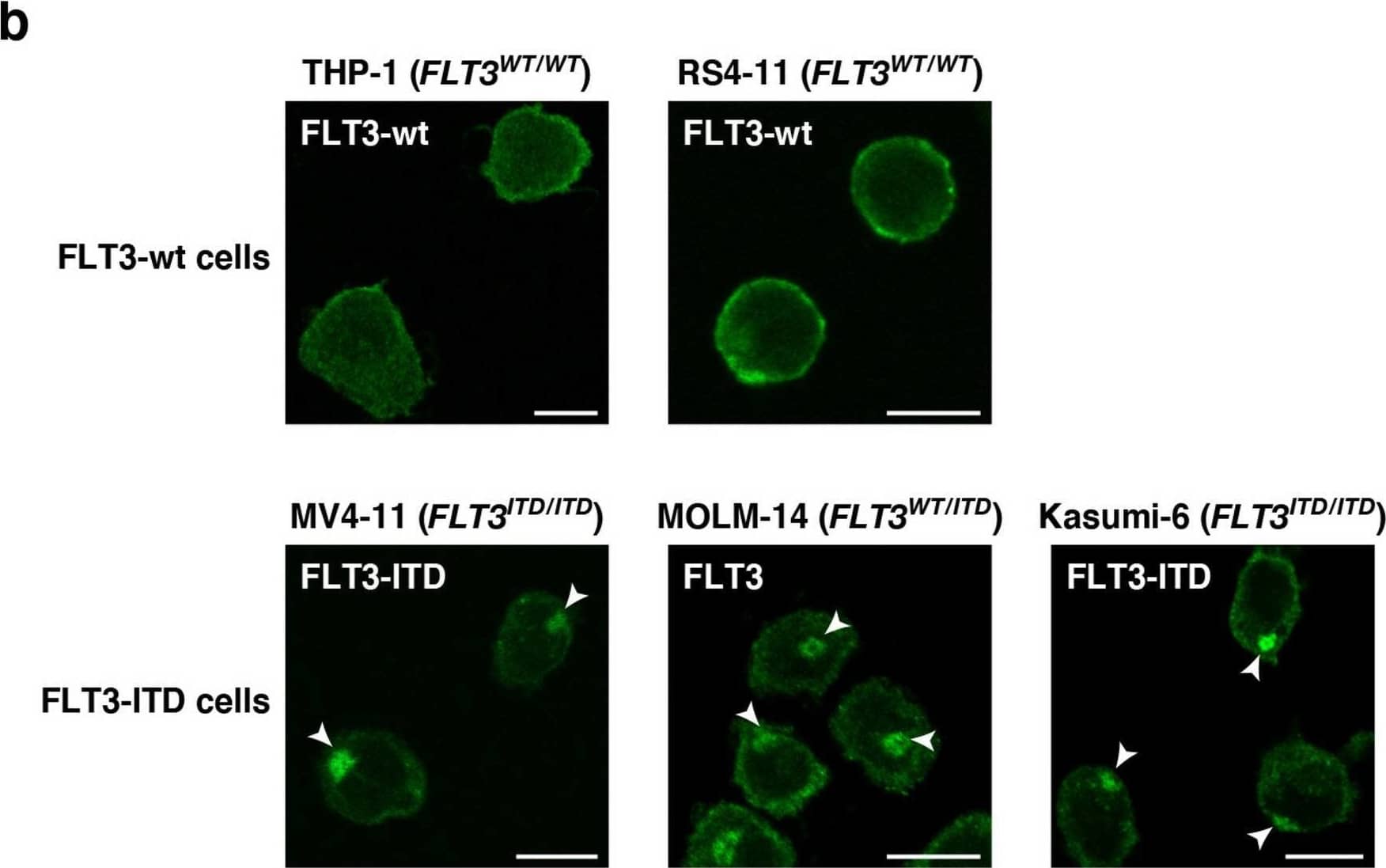 FLT3-ITD mislocalizes to the perinuclear region in AML cells. (a) Schematic representations of wild-type FLT3 (FLT3-wt) and an FLT3 internal tandem duplication (FLT3-ITD) mutant showing the extracellular domain (ECD, blue), the transmembrane domain (TM, yellow), the kinase domain (pink), and the ITD (green). (b) Fixed THP-1, RS4-11, MV4-11, MOLM-14, or Kasumi-6 cells were permeabilized and subsequently immunostained with anti-FLT3 ECD antibody. Arrowheads indicate the perinuclear region. Bars, 10 µm. Note that FLT3-wt localized to the plasma membrane, whereas FLT3-ITD accumulated in the perinuclear region. Image collected and cropped by CiteAb from the following open publication (//pubmed.ncbi.nlm.nih.gov/34811450), licensed under a CC-BY license. Not internally tested by R&D Systems.
