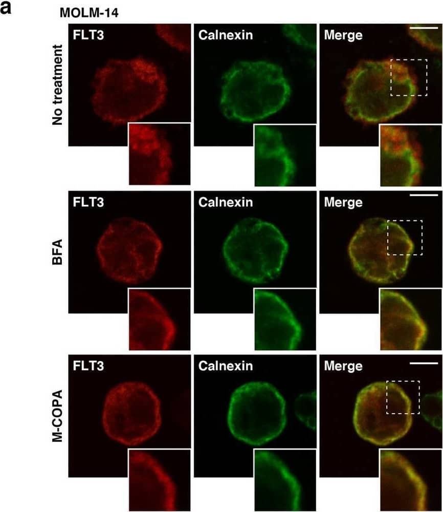 Immunocytochemistry/ Immunofluorescence Flt-3/Flk-2/CD135 Antibody (66903) [Unconjugated]