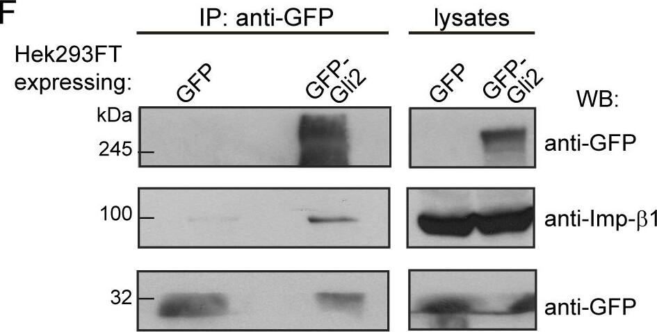 Western Blot Importin beta/KPNB1 Antibody (845208)