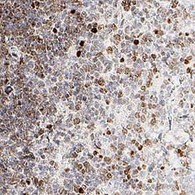 FoxP3 was detected in immersion fixed paraffin-embedded sections of mouse thymus using Rabbit Anti-Human/Mouse FoxP3 Monoclonal Antibody (Catalog # MAB8214) at 15 µg/ml for 1 hour at room temperature followed by incubation with the Anti-Rabbit IgG VisUCyte™ HRP Polymer Antibody (Catalog # VC003). Before incubation with the primary antibody, tissue was subjected to heat-induced epitope retrieval using VisUCyte Antigen Retrieval Reagent-Basic (Catalog # VCTS021). Tissue was stained using DAB (brown) and counterstained with hematoxylin (blue). Specific staining was localized to the nucleus. View our protocol for IHC Staining with VisUCyte HRP Polymer Detection Reagents.